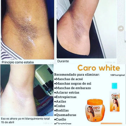 CARO WHITE JAR CREAM